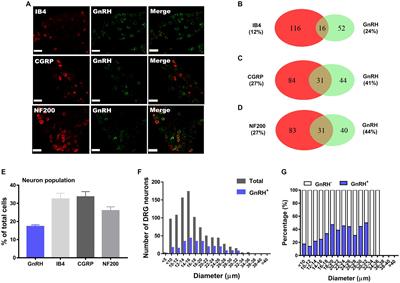 GnRH peripherally modulates nociceptor functions, exacerbating mechanical pain